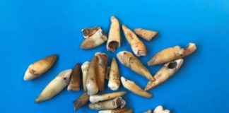 1,000 Human Teeth Uncovered in Excavation for Australian Subway