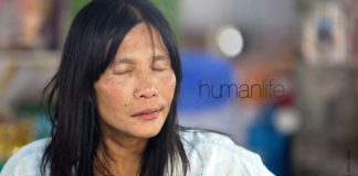 Why Doesn’t Your Vision ‘Go Dark’ When You Blink?