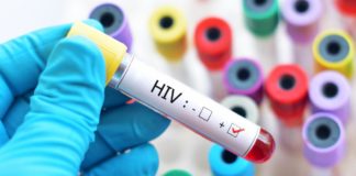 HIV Can Lie Dormant in the Brain. Here’s What That Means.