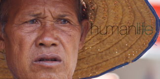 Is That ‘Midlife Crisis’ Really Alzheimer’s Disease?