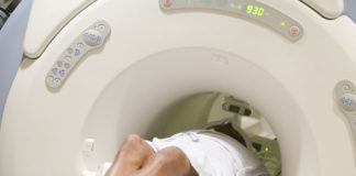 What Are CT Scans and How Do They Work?