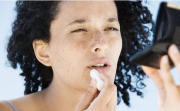 Can Lip Balm Make Your Chapped Lips Worse?