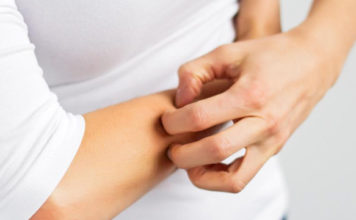 Human Shingles: Causes, Symptoms and Treatment Human Shingles: Causes, Symptoms and Treatment