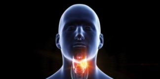 Persistent sore throat ‘can be cancer sign’