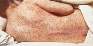 Jetstar measles alert: Fears passengers on three flights between Thailand, Australia and New Zealand could be infected with the disease