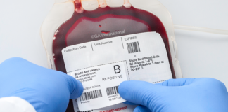 What’s the Most Common Human Blood Type?