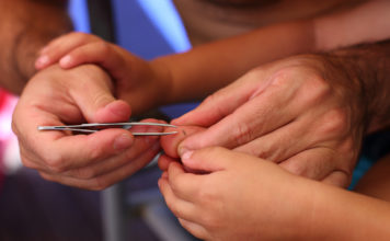 What Happens If You Don’t Take Out a Splinter? What Happens If You Don’t Take Out a Splinter?