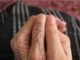 What Are Human Wrinkles?